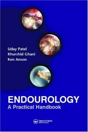 Endourology A Practical Handbook 1st Edition Uday Patel Kenneth M Anson