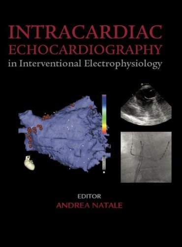 Intracardiac Echocardiography In Interventional Electrophysiology Advanced Management Of Atrial Fibrillation And Ventricular Tachycardia 1st Edition Andrea Natale