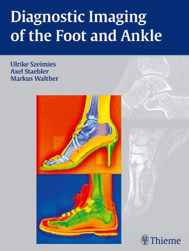 Diagnostic Imaging Of The Foot And Ankle First Ulrike Szeimies Editor