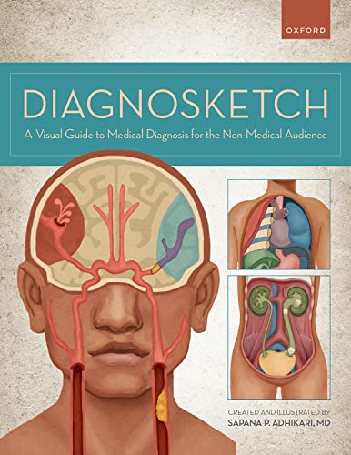 Diagnosketch Adhikari Sapana