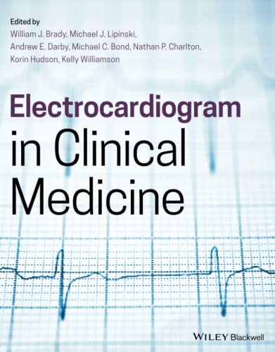 Electrocardiogram In Clinical Medicine 1st Edition William J Brady