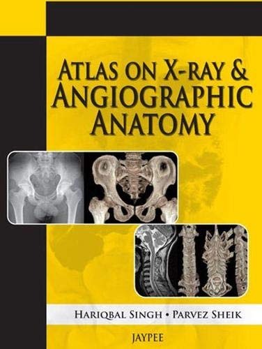 Atlas On Xray And Angiographic Anatomy 1st Edition Hariqbal Singh