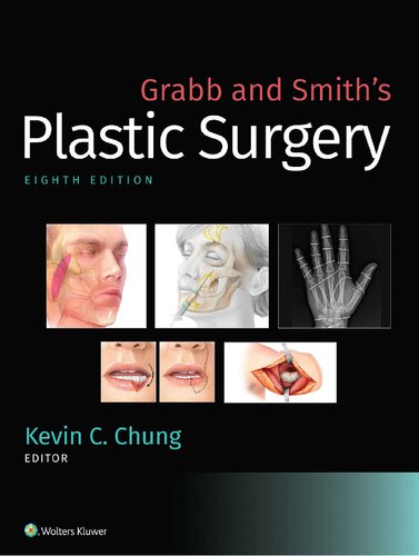 Grabb And Smiths Plastic Surgery 8th Edition Hq Pdf 8th Edition Kevin C Chung