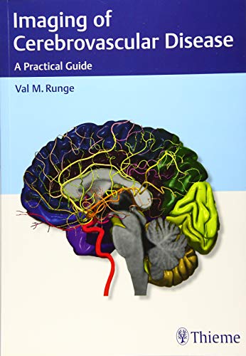 Imaging Of Cerebrovascular Disease A Practical Guide 1st Edition Val M Runge