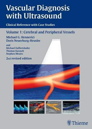 Vascular Diagnosis With Ultrasound Clinical Reference With Case Studies Volume 1 Cerebral And Peripheral Vessels 2nd Revised Doris Neuerburgheusler