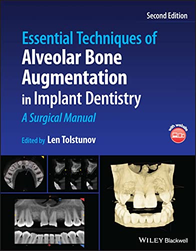 Essential Techniques Of Alveolar Bone Augmentation In Implant Dentistry A Surgical Manual 2nd Edition 2nd Len Tolstunov