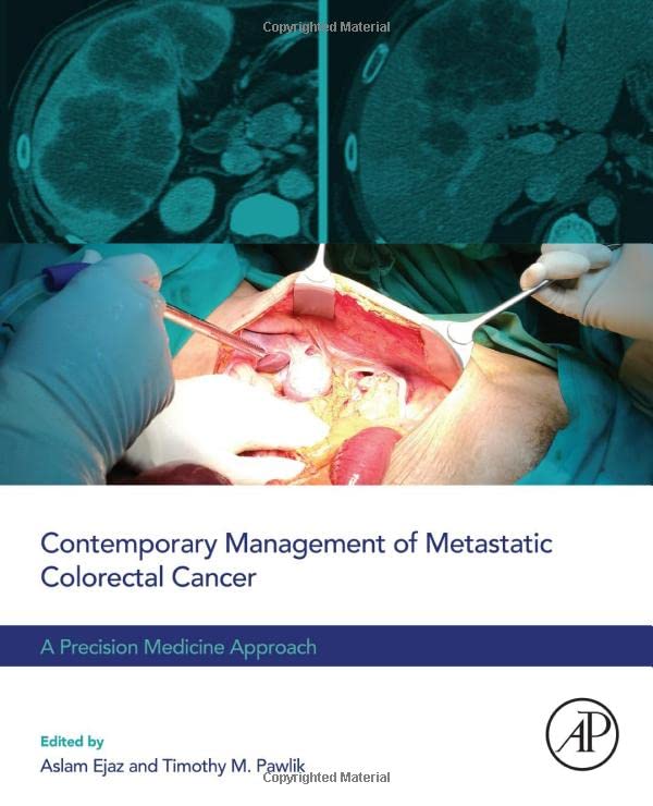 Contemporary Management Of Metastatic Colorectal Cancer A Precision Medicine Approach 1st Edition Aslam Ejaz