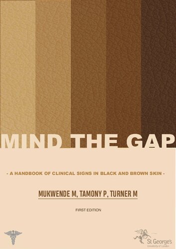 Mind The Gap A Handbook Of Clinical Signs In Black And Brown Skin First Mukwende M