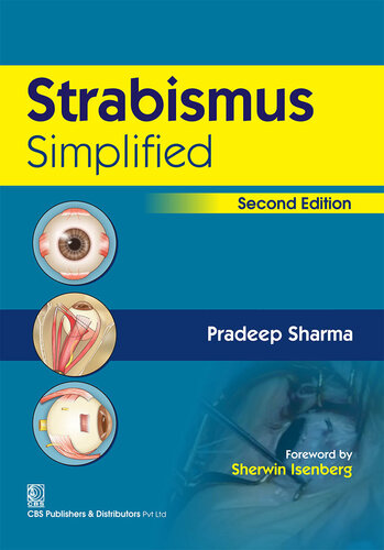 Strabismus Simplified 2e With Pb 2nd Edition Pradeep Insan Sharma