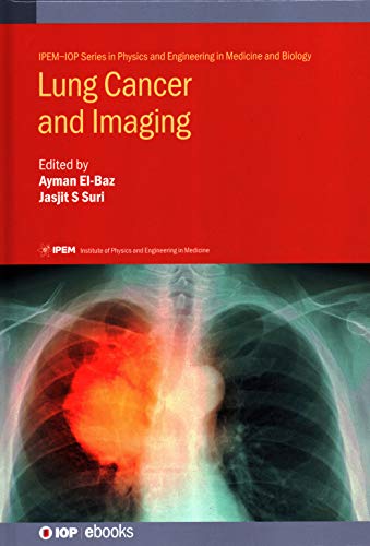 Lung Cancer And Imaging Ayman Elbaz Jasjit S Suri