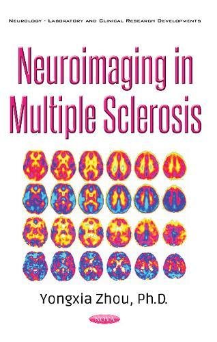 Neuroimaging In Multiple Sclerosis Neurologylaboratory And Clinical Research Developments Zhou