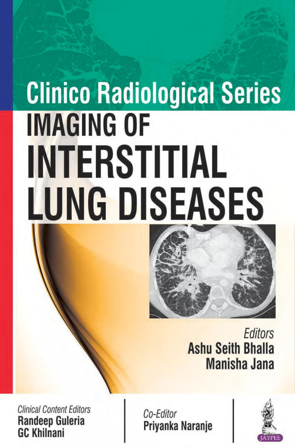 Imaging Of Interstitial Lung Diseases Clinico Radiological April 30 2017938632251xjaypee Brothers Medical Pubpdf Ashu Seith Bhalla Manisha Jana