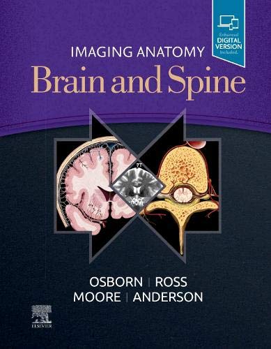 Imaging Anatomy Brain And Spine 1e 2020 1st Edition Anne G Osborn Karen L Salzman Jeffrey S Anderson Arthur W Toga Meng Law Jeffrey Ross Kevin R Moore