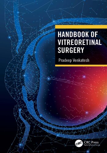Handbook Of Vitreoretinal Surgery Pradeep Venkatesh