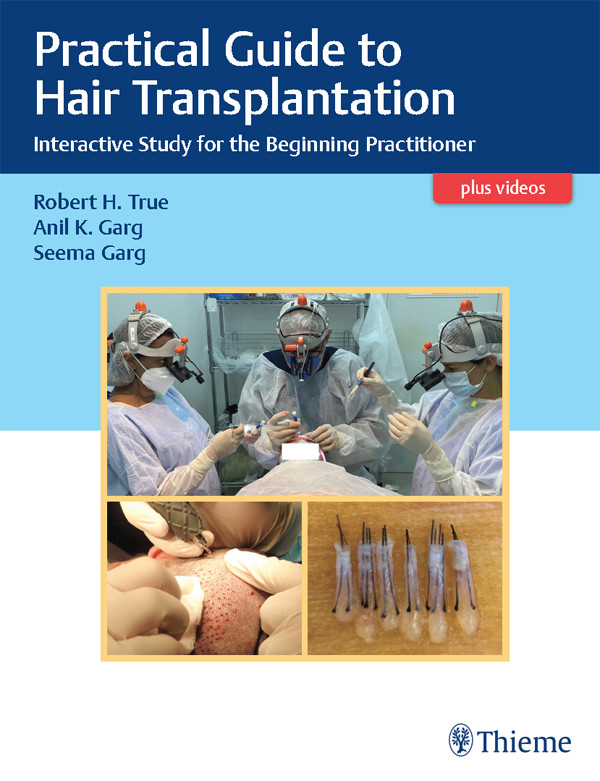 Practical Guide To Hair Transplantation Interactive Study For The Beginning Practitioner 1st Edition Robert True