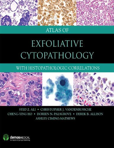 Atlas Of Exfoliative Cytopathology With Histopathologic Correlations Ali Md Frcpath Fiac Syed Z Syed Z Ali