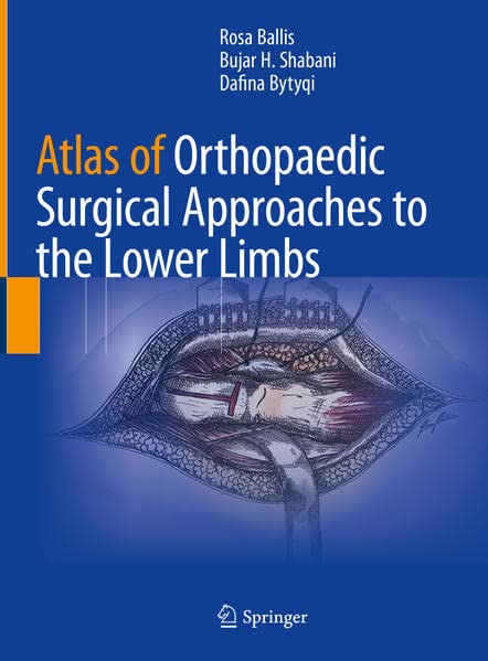 Atlas Of Orthopaedic Surgical Approaches To The Lower Limbs Rosa Ballis