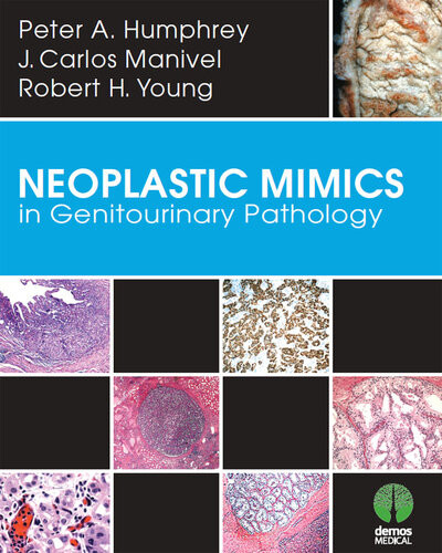 Neoplastic Mimics In Genitourinary Pathology Humphrey Peter A