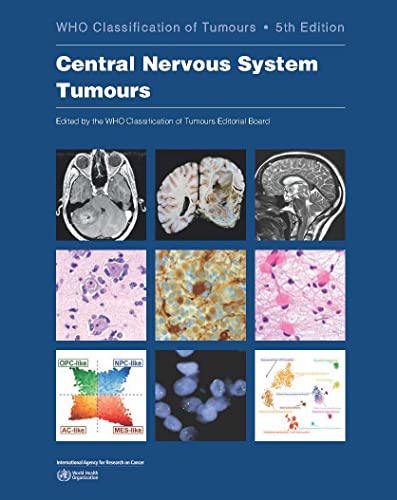 Central Nervous System Tumours Who Classification Of Tumours 5th Edition Who Classification Of Tumours Editorial Board