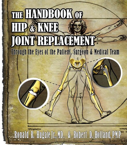 Handbook Of Hip Knee Joint Replacement Through The Eyes Of The Patient Surgeon Medical Team Robert Holland
