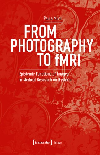 From Photography To Fmri Epistemic Functions Of Images In Medical Research On Hysteria Paula Muhr