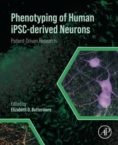 Phenotyping Of Human Ipscderived Neurons Patientdriven Research Elizabeth D Buttermore