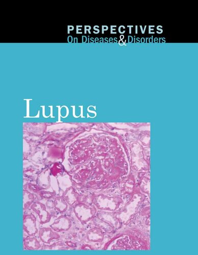 Lupus Hayley Mitchell Haugen