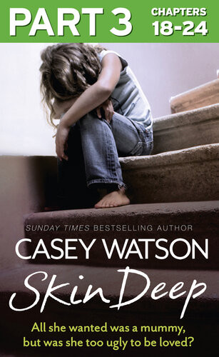 Skin Deep Part 3 Of 3 All She Wanted Was A Mummy But Was She Too Ugly To Love Casey Watson