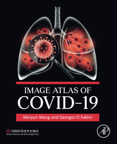 Image Atlas Of Covid19 1st Meiyun Wang Georges El Fakhri
