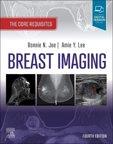 Breast Imaging The Core Requisites 4th Edition Bonnie N Joe