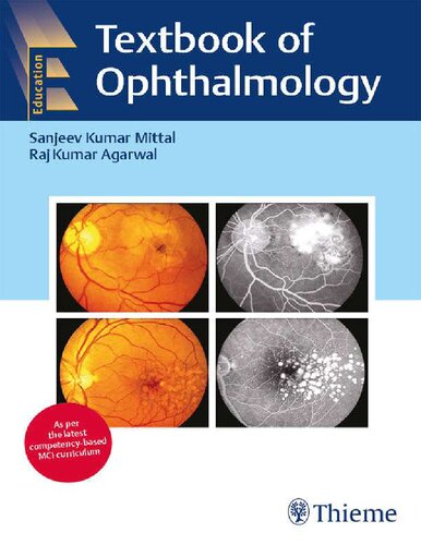 Textbook Of Ophthalmology Textbook Of Ophthalmology Sanjeev Kumar Mittal