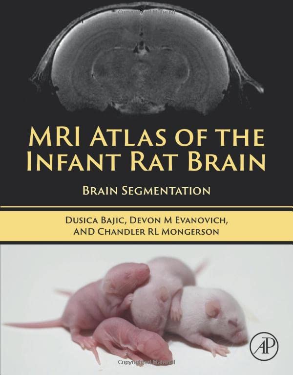Mri Atlas Of The Infant Rat Brain Brain Segmentation Dusica Bajic