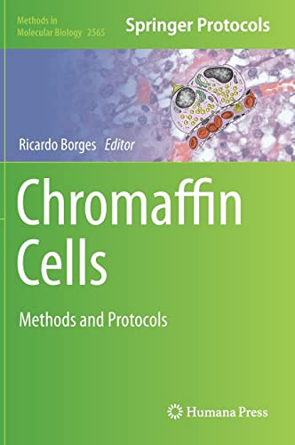 Chromaffin Cells Ricardo Borges