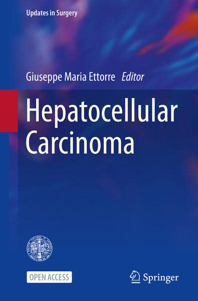 Hepatocellular Carcinoma Giuseppe Maria Ettorre