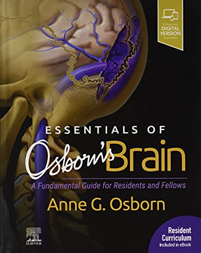 Essentials Of Osborns Brain A Fundamental Guide For Residents And Fellows 1st Anne G Osborn