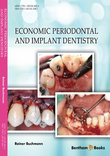 Economic Periodontal And Implant Dentistry Rainer Buchmann