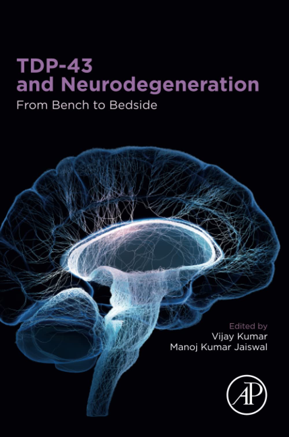 Tdp43 And Neurodegeneration From Bench To Bedside 1st Edition Vijay Kumar