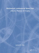 Mechanical Lumbosacral Spine Pain Anatomy Histology And Imaging Lynton Gf Giles