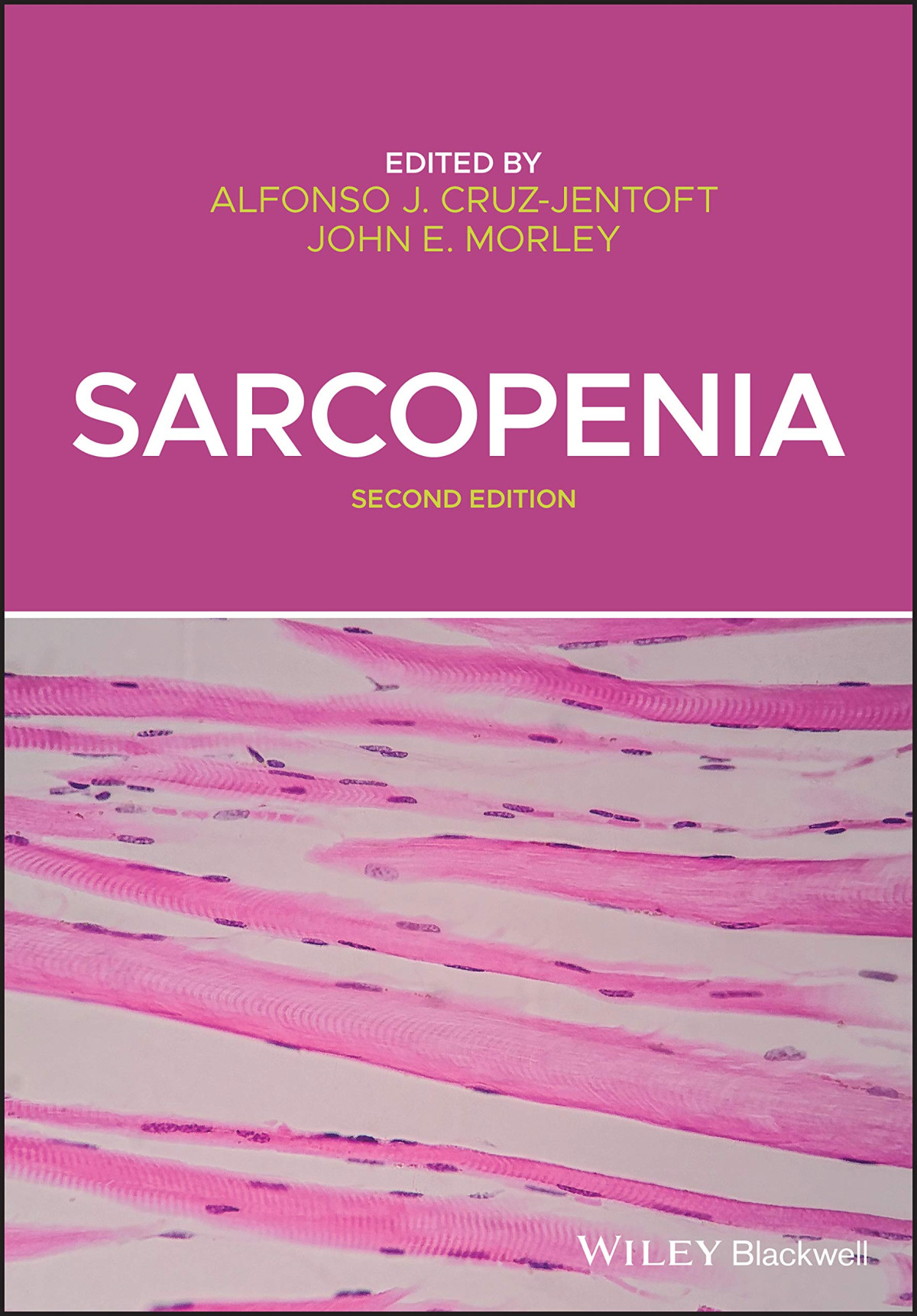 Sarcopenia 2nd Edition John E Morley Alfonso J Cruzjentoft