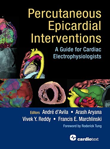 Percutaneous Epicardial Interventions A Guide For Cardiac Electrophysiologists Andre Davila
