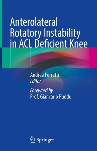 Anterolateral Rotatory Instability In Acl Deficient Knee Andrea Ferretti