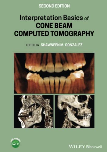 Interpretation Basics Of Cone Beam Computed Tomography 2nd Edition Shawneen M Gonzalez Editor