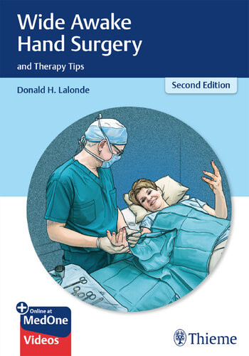 Wide Awake Hand Surgery And Therapy Tips 2nd Edition Donald Lalonde
