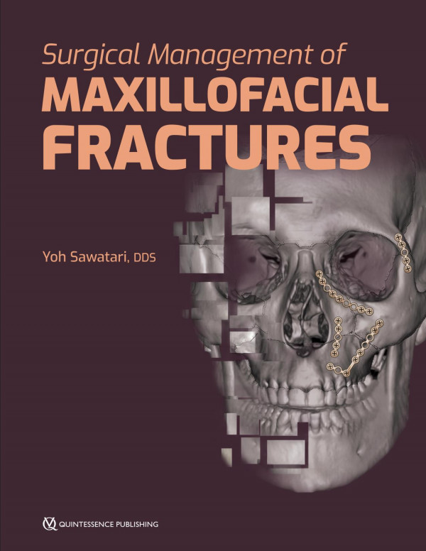 Surgical Management Of Maxillofacial Fractures Yoh Sawatari