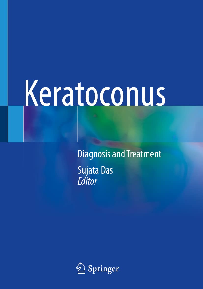 Keratoconus Diagnosis And Treatment 1st Sujata Das