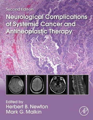Neurological Complications Of Systemic Cancer And Antineoplastic Therapy 2nd Edition Herbert B Newton