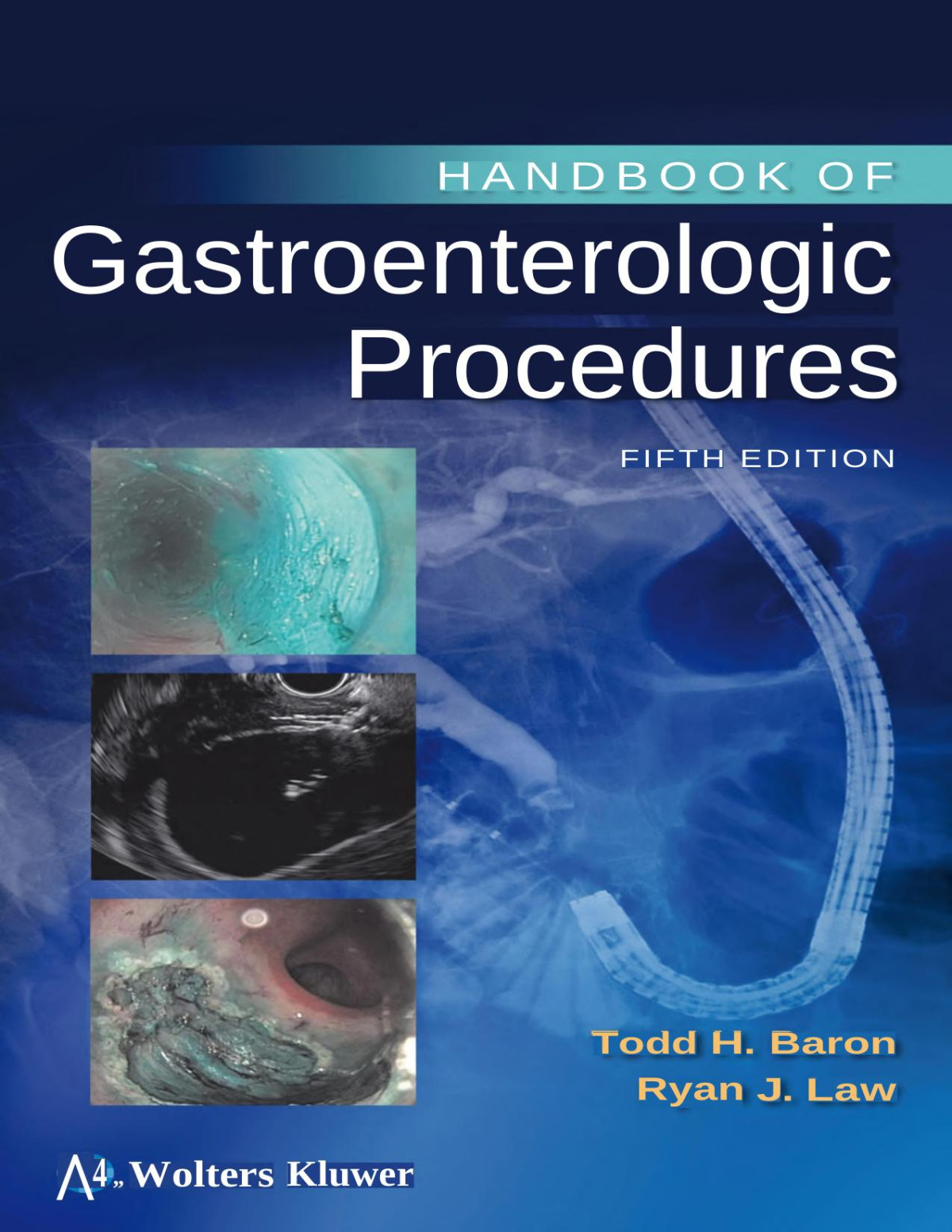 Handbook Of Gastroenterologic Procedures Baron Todd Hlaw Ryan Alexis Chiang Colvin
