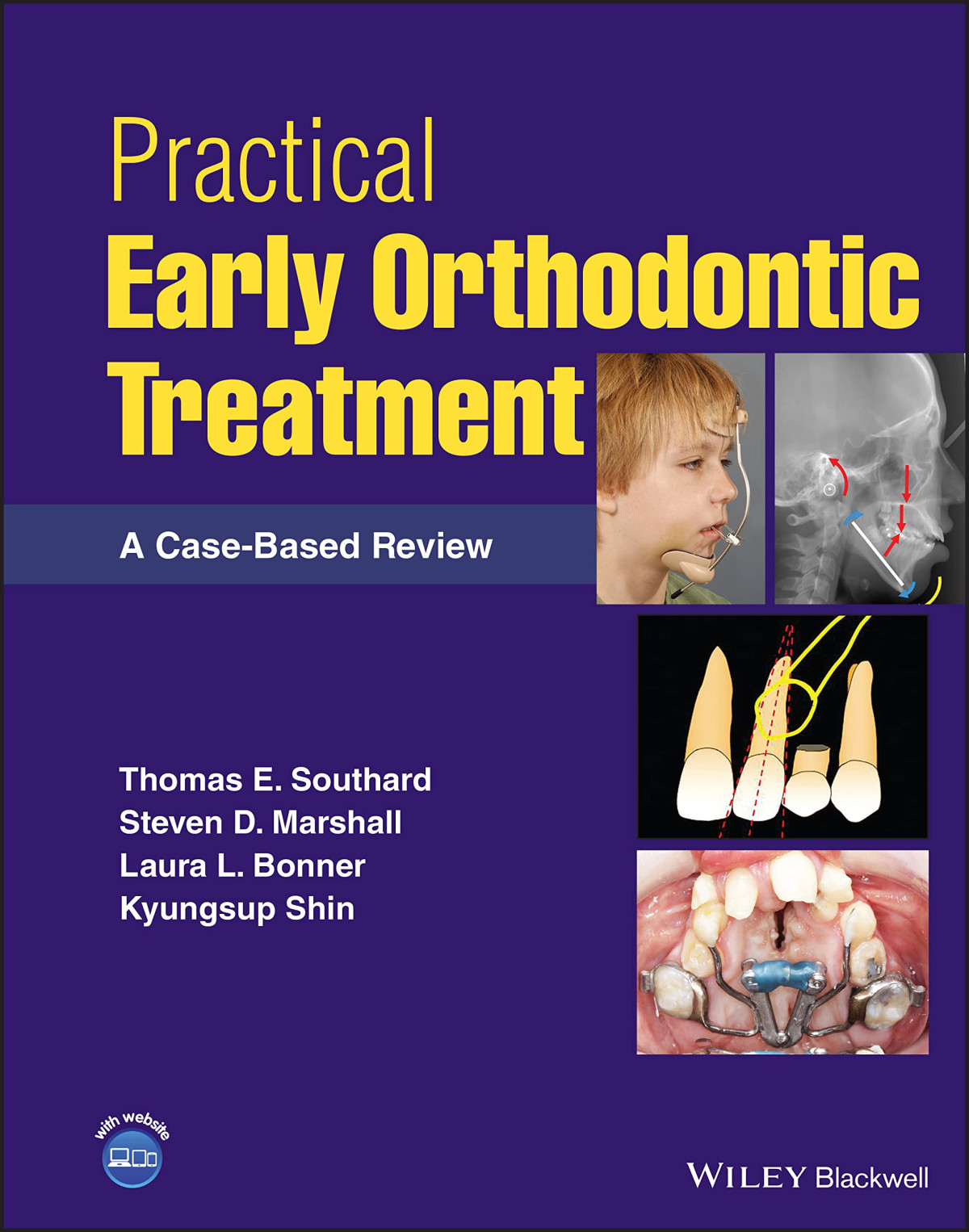 Practical Early Orthodontic Treatment A Casebased Review Thomas E Southard