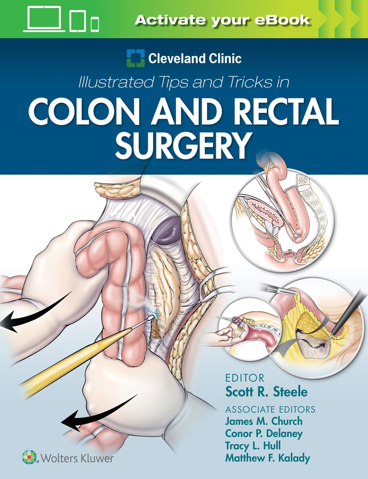 Cleveland Clinic Illustrated Tips And Tricks In Colon And Rectal Surgery 1st Edition Scott Steele