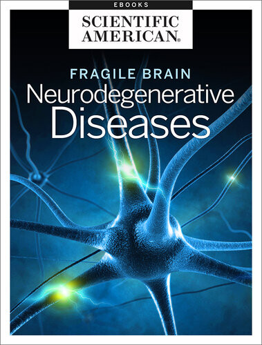 Fragile Brain Neurodegenerative Diseases Scientific American Editors